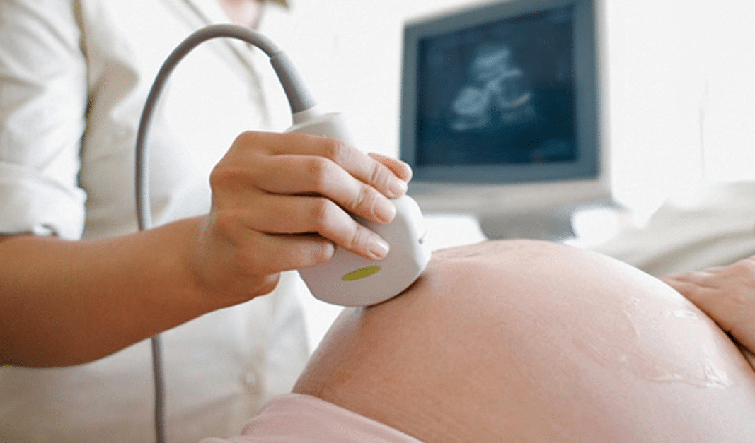Siêu âm thai là phương pháp chẩn đoán hình ảnh an toàn cho thai nhi