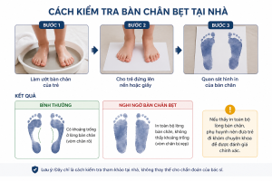 Cách kiểm tra bàn chân bẹt cho trẻ